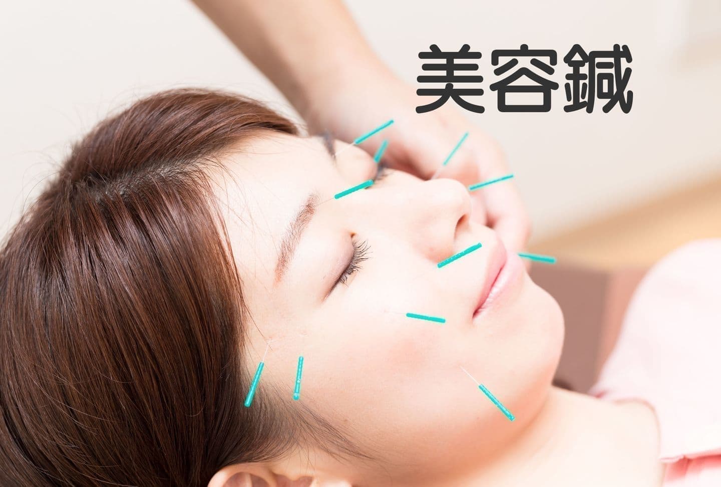 美容鍼写真