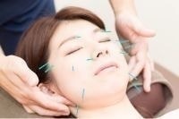 美容鍼