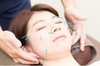 美容鍼
