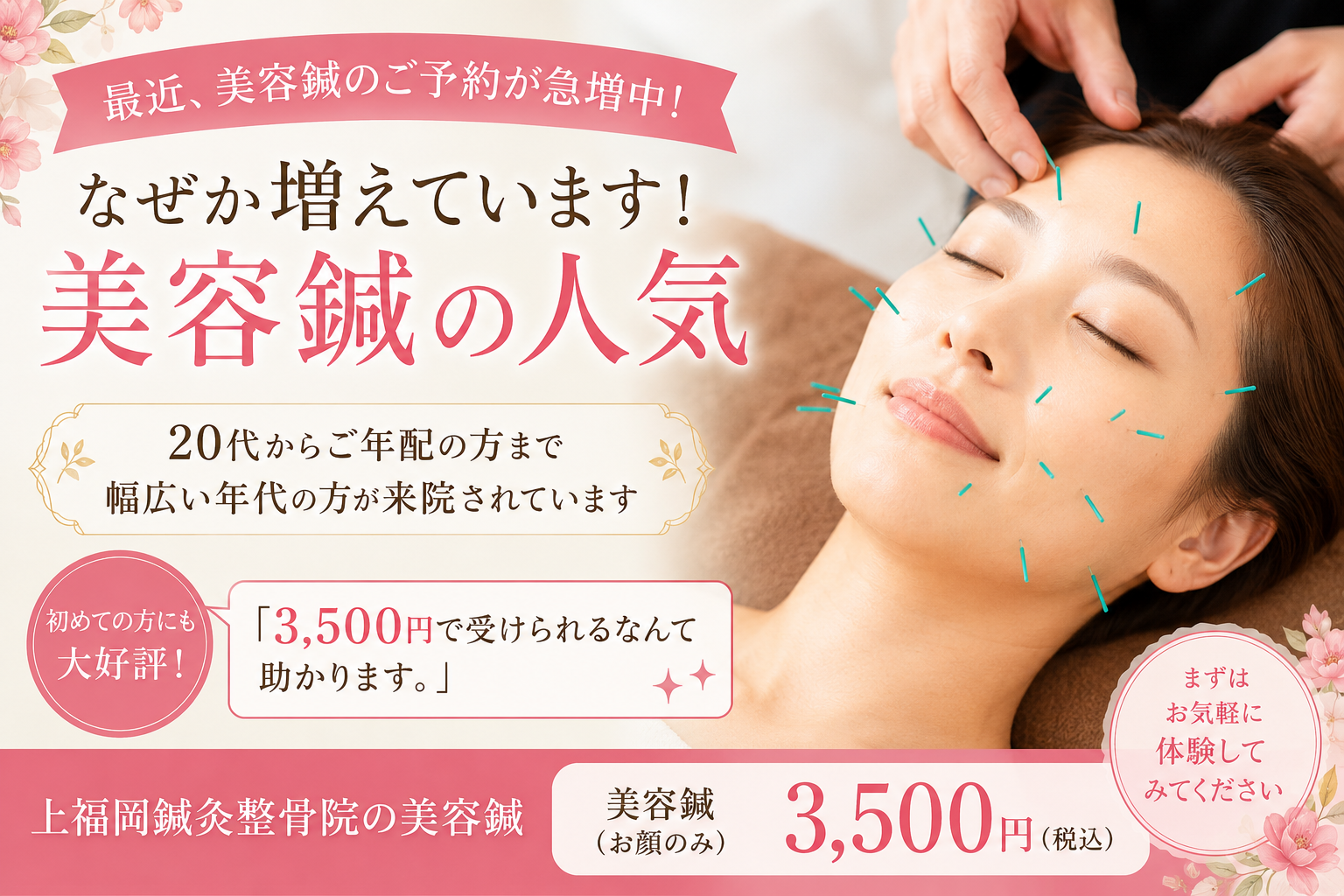 美容鍼が増えています