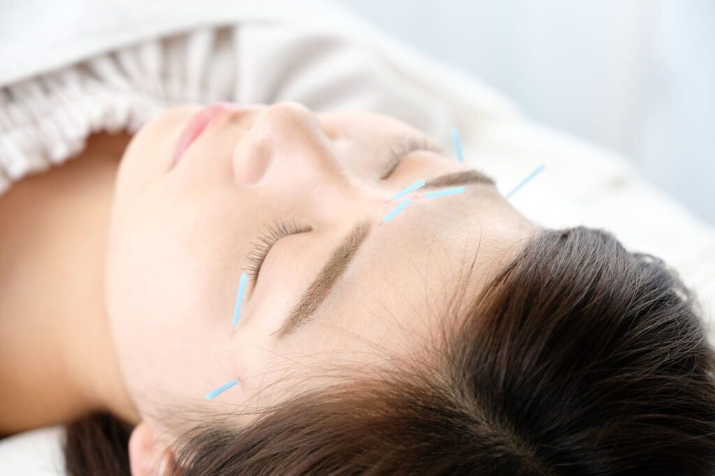 美容鍼をする女性